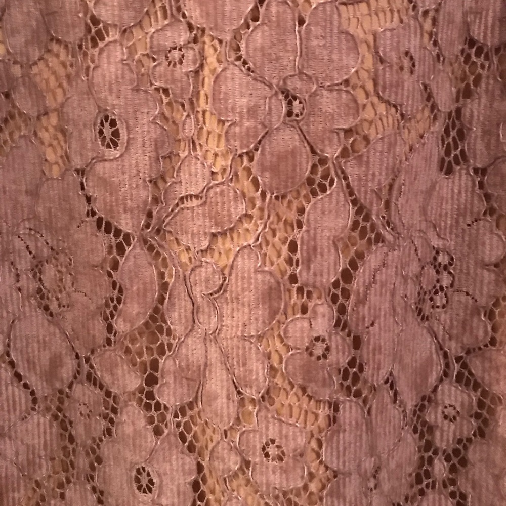 Free People dress - Picture 3 of 5